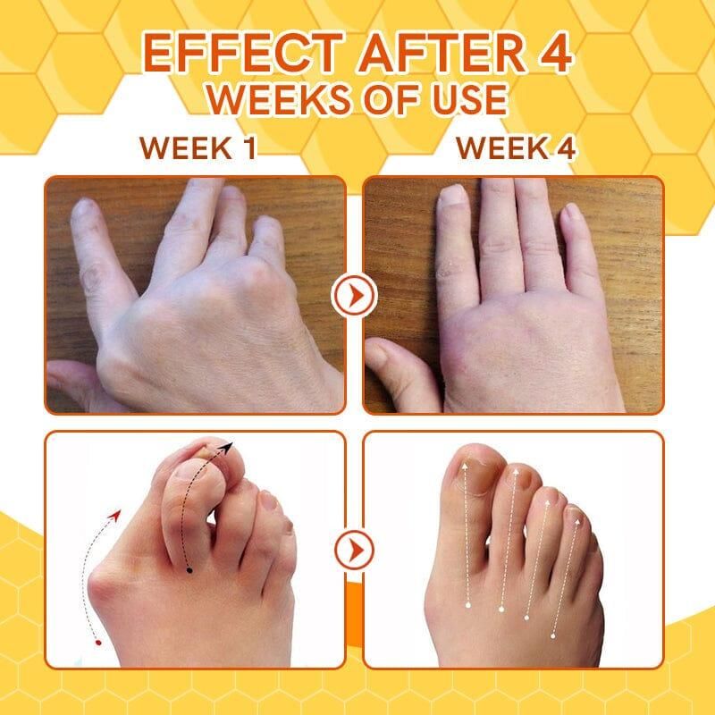 Bee Venom Vein Relief Spray