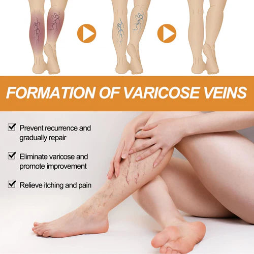 Bee Venom Vein Relief Spray