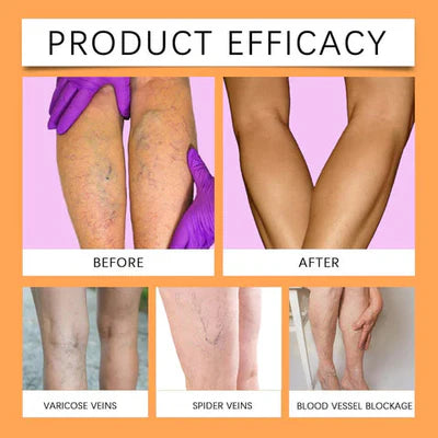 Bee Venom Vein Relief Spray