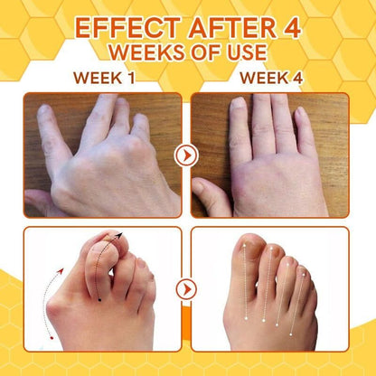 Bee Venom Vein Relief Spray