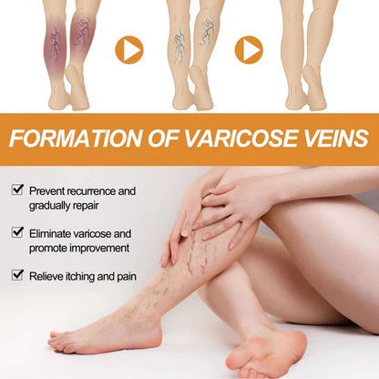 Bee Venom Vein Relief Spray